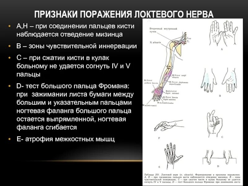 Объем движений в лучезапястном суставе. Отведение пальцев кисти. Угол сгибания в лучезапястном суставе. Отведение и приведение лучезапястного сустава. Отведение мизинца.