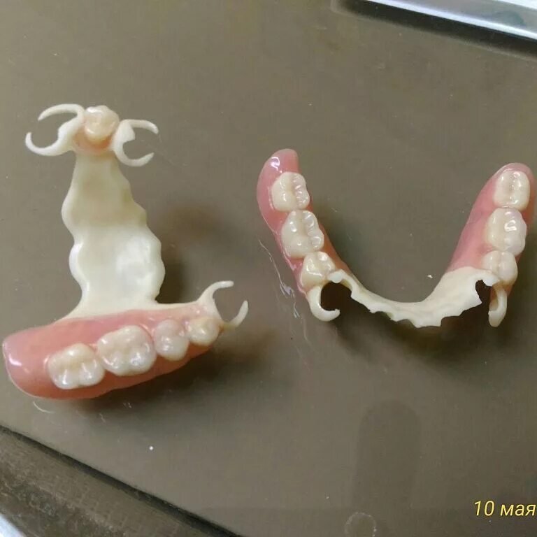 зубные протезы квадротти отзывы