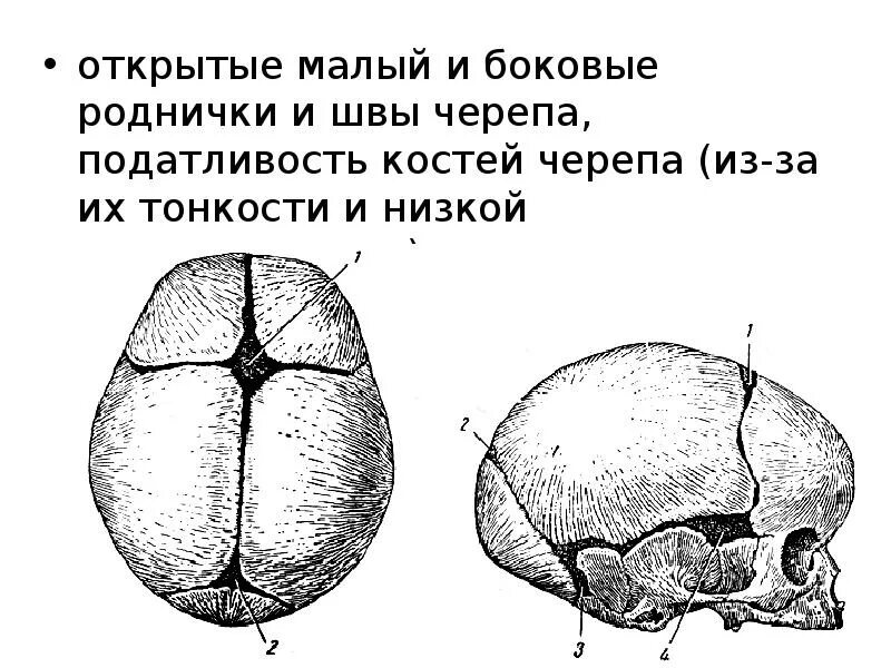 Швы и роднички. Роднички черепа анатомия. Швы и роднички черепа. Кости черепа новорожденного роднички. Череп новорожденного кости швы роднички.