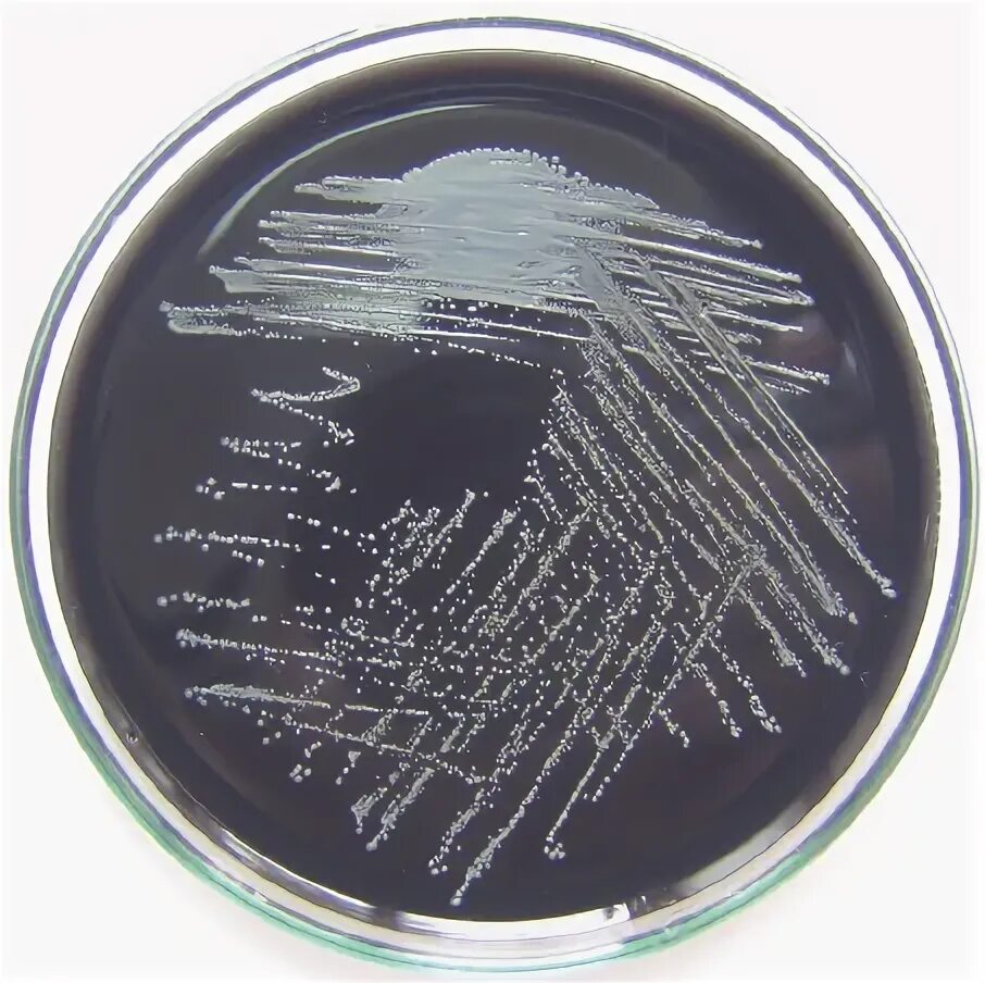 Колонии Bordetella pertussis. Коклюш Bordetella pertussis (бордетелла пертуссис). Bordetella pertussis на казеиново-угольном агаре. Колонии бордетелла пертуссис на среде борде Жангу. Anti bordetella pertussis положительный