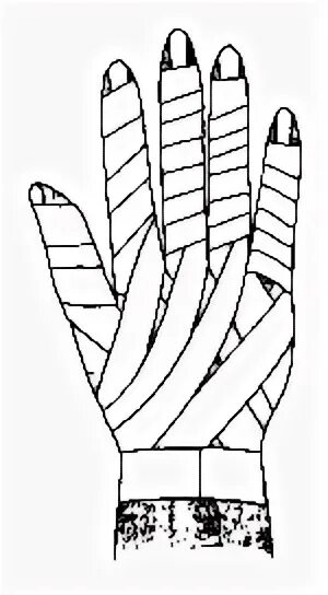 Техника наложения повязки перчатка