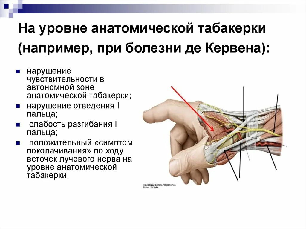 Невропатия локтевого нерва лечение. Невропатия лучевого нерва. Туннельный синдром лучевого нерва. Нейропатия срединного нерва.