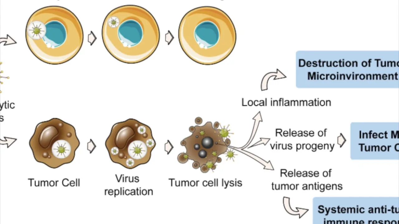Local virus. Oncolytic viruses. Oncolytic virus FDA 2015. Экзосомы и вирусы. Viral Therapy of Cancer.