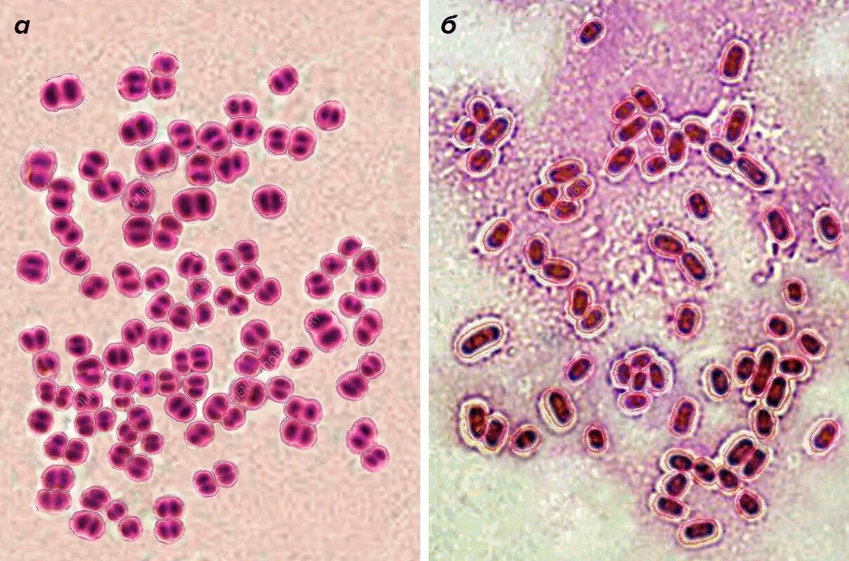 Chlamydia trachomatis neisseria gonorrhoeae. Нейссерии менингококки. Менингококк диплококк Neisseria meningitidis. Диплококки менингококки.