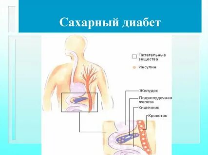 Диабет желудка