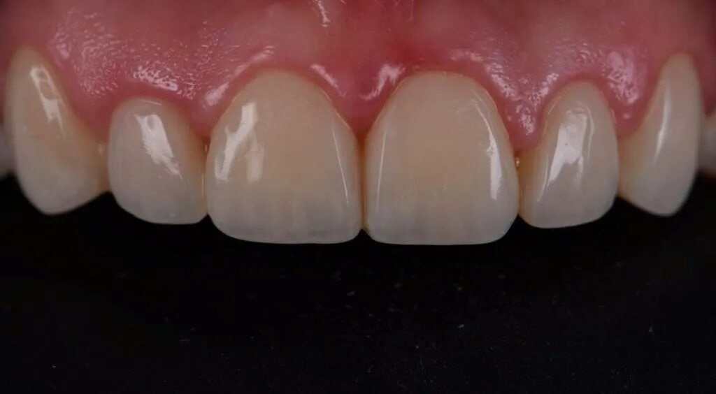 Виктор Щербаков. Про философию дзен. Часть 1 / Viktor Scherbakov about Zen Denti