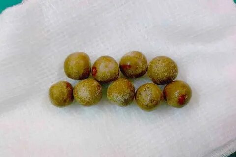 Через какое время выйдет камень