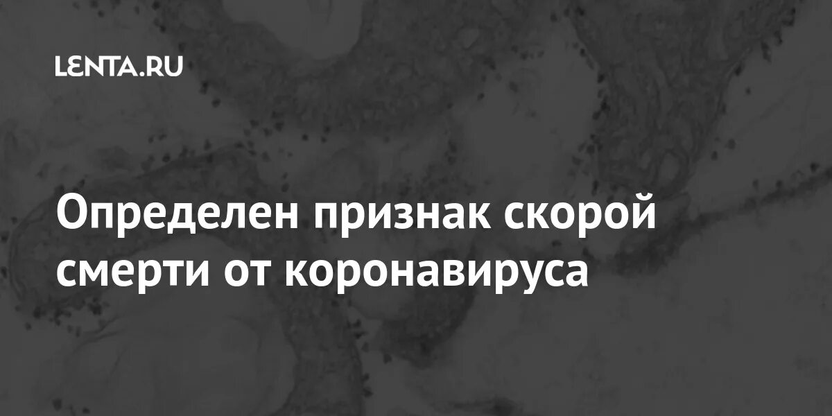 Приметы скорой смерти. Первый признак скорой смерти. Магические признаки скорой смерти. Необычные признаки скорой смерти.