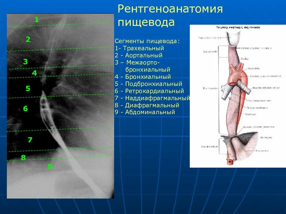 Поверхность пищевода