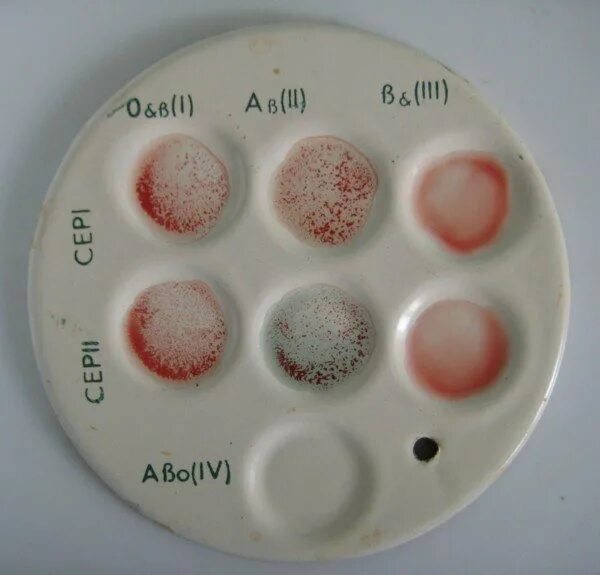 Чашка Петри для определения группы крови. Группа крови Цоликлоны резус фактор. Планшетка для определения группы крови. Определение группы крови и резус фактора цоликлонами таблица. Группа крови по цоликлонам