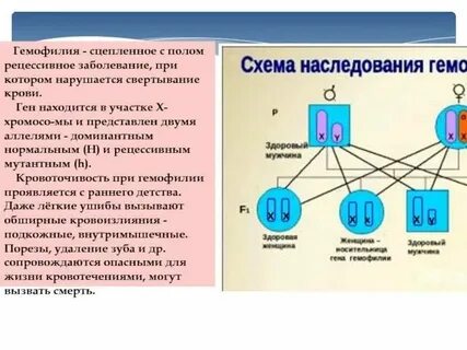 Выявление сцепленности признака с полом у человека