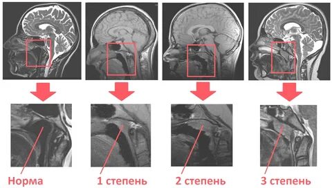 3 2 кт