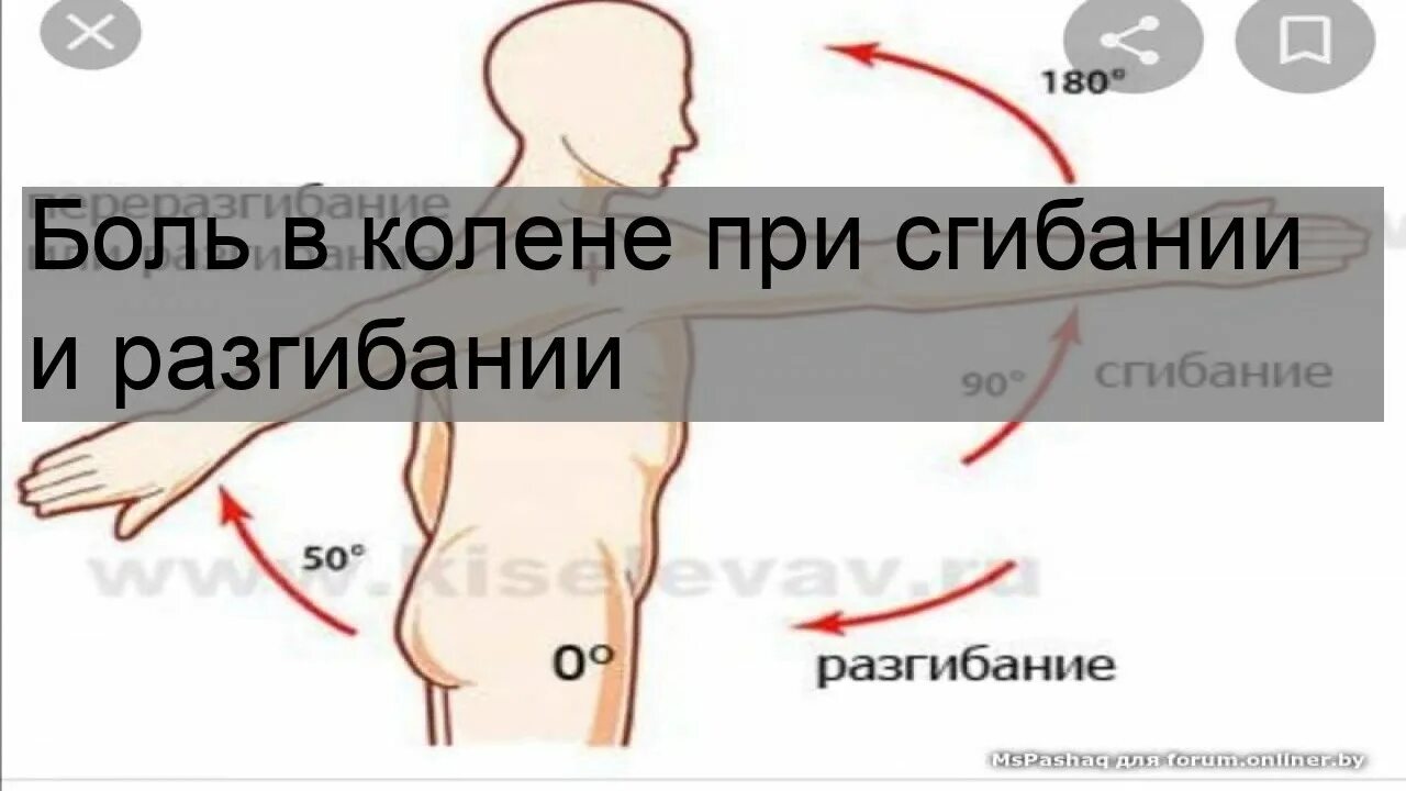 Сильные боли при разгибании колена. Боль в колене при сгибании и разгибании. Ноющая боль в колене при сгибании. Колено болит при сгибании и разгибании. Болит правое колено при сгибании и разгибании.