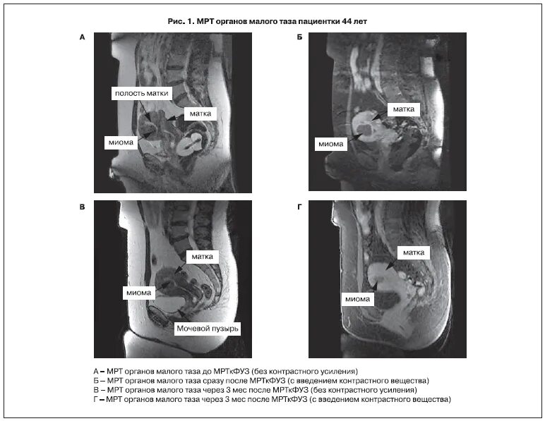 Кт при месячных можно. Магнитно-резонансная томография органов малого таза. Мрт малого таза. Мрт малого таза снимки. Мрт органов малого таза снимки.