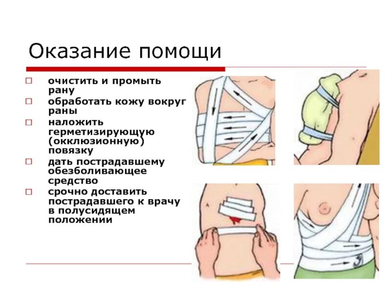 Повязка на грудную клетку алгоритм. Пневмоторакс окклюзионная повязка. Окклюзионная повязка при открытом пневмотораксе. Наложение окклюзионной повязки алгоритм. Окклюзионная герметизирующая повязка.