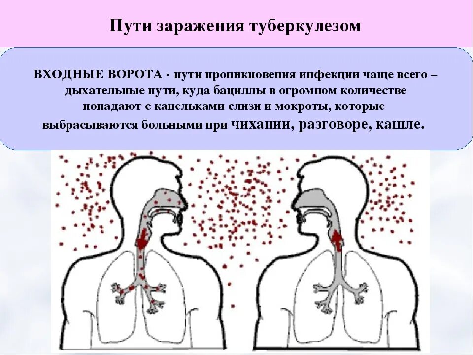 Пути заражения туберкулезом. Входные ворота инфекции туберкулеза. Пути передачи туберкулеза. Инфекции дыхательных путей заболевания.