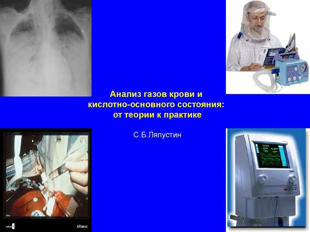 Исследование газов крови. Исследование кислотно-основного состояния и газов крови. Исследование КЩС. Исследование газового состава крови.