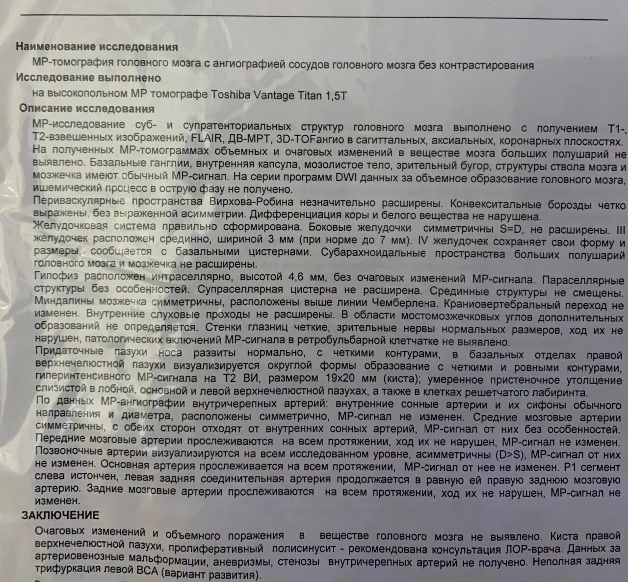 Арахноидальная киста задней черепной ямки кт. Ретроцеребеллярная арахноидальная киста мрт. Киста головного мозга заключение. Ретроцеребеллярная киста головного мозга лечение. Ретроцеребеллярная арахноидальная киста.