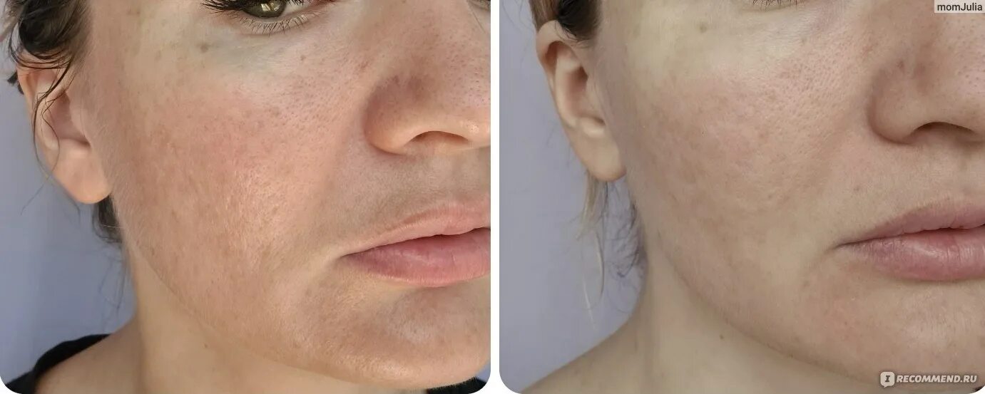 Альгинатная маска отзывы до и после фото Альгинатная маска Inoface YOGHURT MODELING MASK "Корейские альгинатные маски с