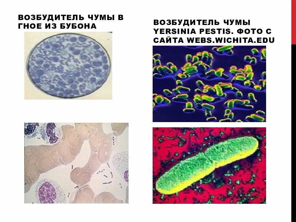 Иммунитет возбудителя чумы