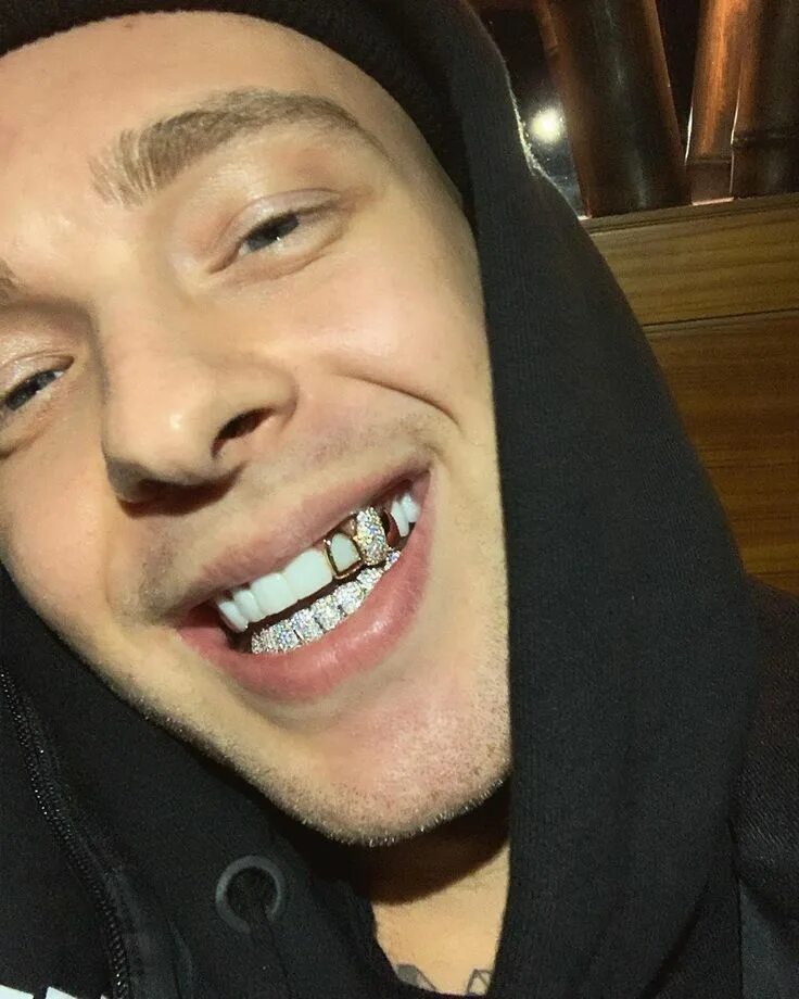 Зубы блоггеров