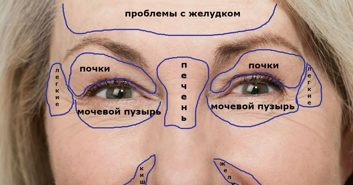 Точки около глаз. Физиогномика межбровная складка. Прыщи на лбу между бровями.