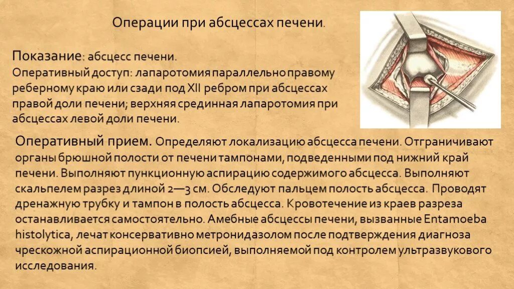 Печень после операции. Операции при абсцессах печени. Абсцесс печени операция. Оперативный доступ при абсцессе печени.