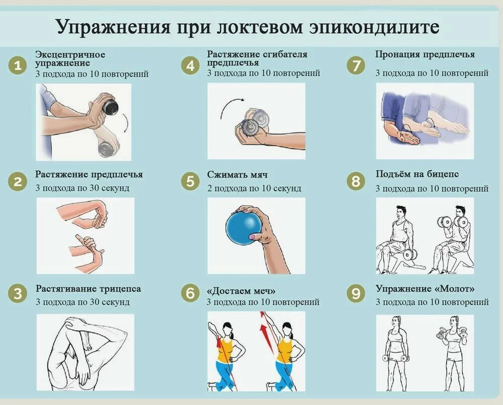 Эпикондилит локтевого сустава код по мкб 10. Эпикондилит локтевого сустава лфк. упражнения при эпикондилите локтевого сустава. упражнения при локте теннисиста. синдром локоть теннисиста.