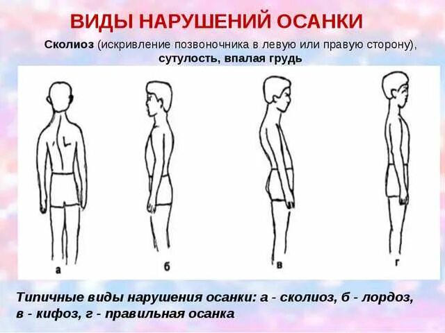 Осанкой принято называть