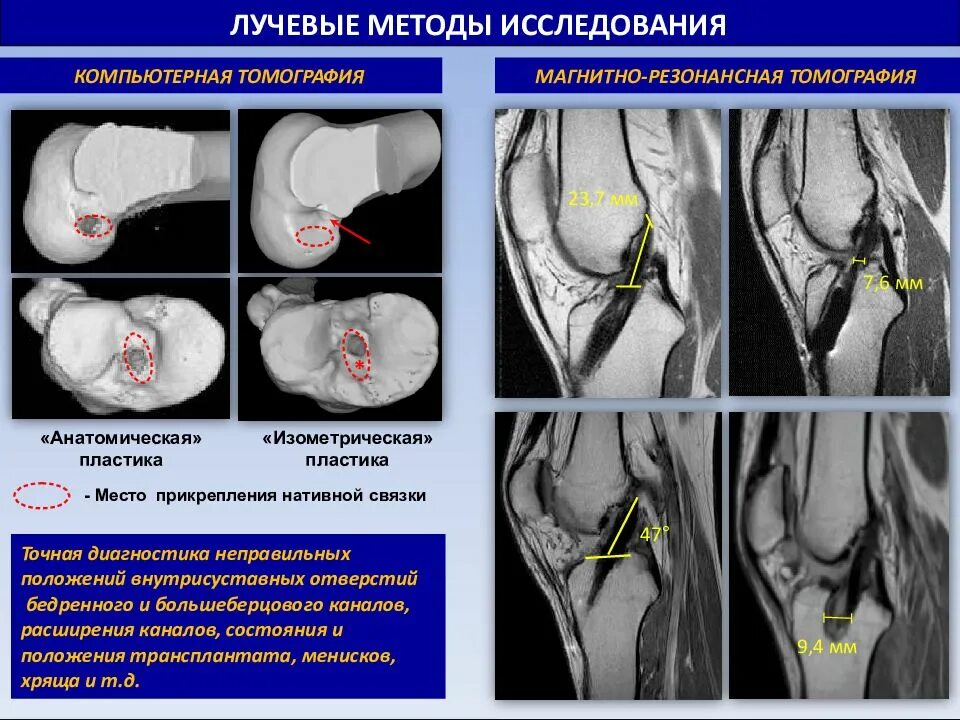 Метод радиальных