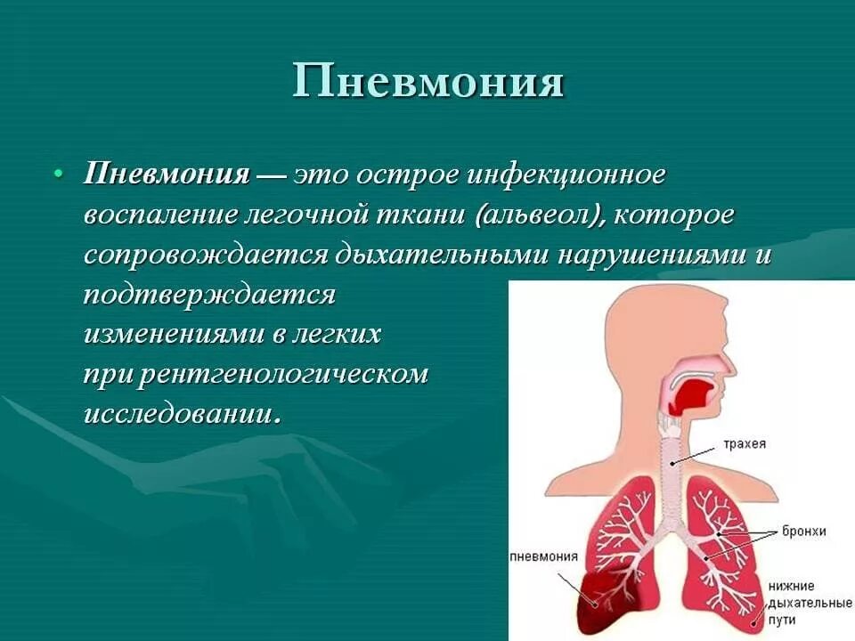 Кашель появляется при заболевании