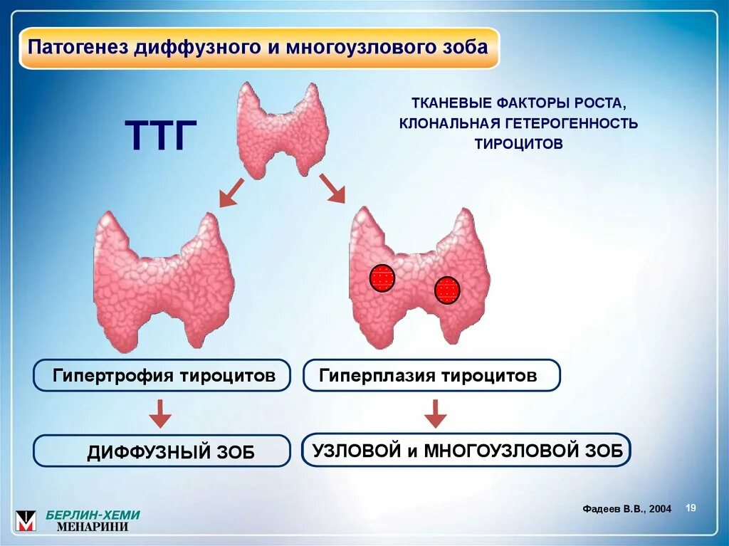 Узловатый гипертиреоидный зоб патогенез. Узловой токсический зоб патогенез. Разрастание щитовидной железы. Этиология зоба щитовидной железы. Многоузловой диффузный
