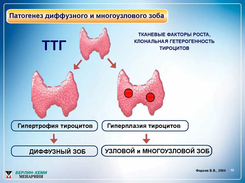 Узловатый гипертиреоидный зоб патогенез. Узловой токсический зоб патогенез. Разрастание щитовидной железы. Этиология зоба щитовидной железы. Диффузно многоузловой зоб