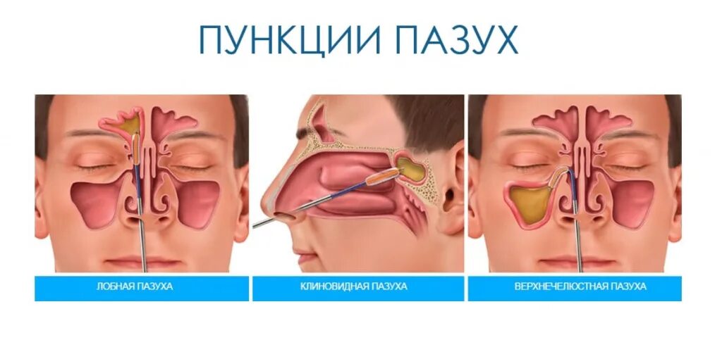 Пазуха выгнать