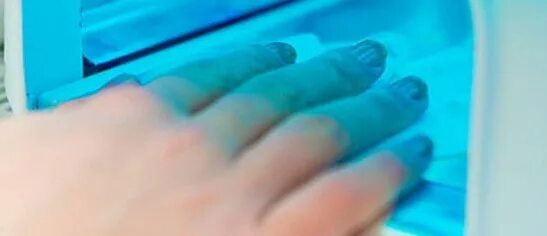 Самый ужасный маникюр. Псевдомония синегнойная палочка это на ногтях. Травматичный онихолизис. Псориатический онихогрифоз. Ногтевой онихолизис онихолизис пластины.