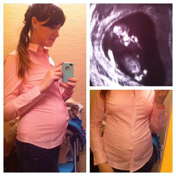 Беременность 14 недель отзывы. 14-15 Недель беременности. Беременность в 14.