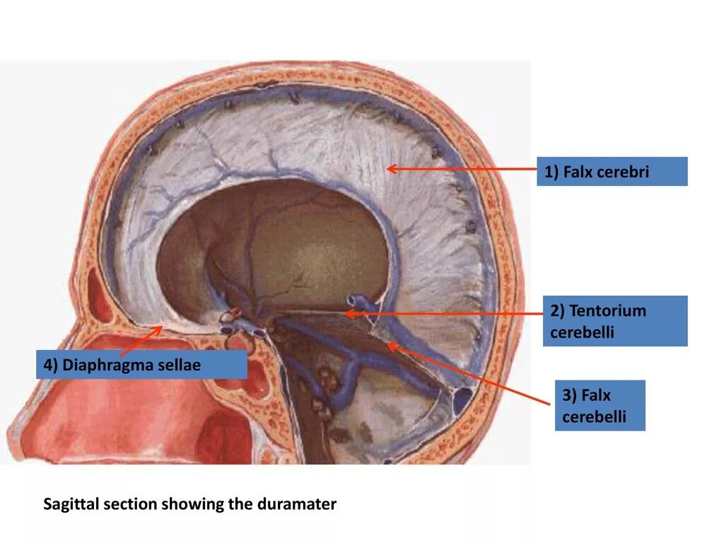 Diaphragma sellae. Falx Cerebri кт. Диафрагма черепа