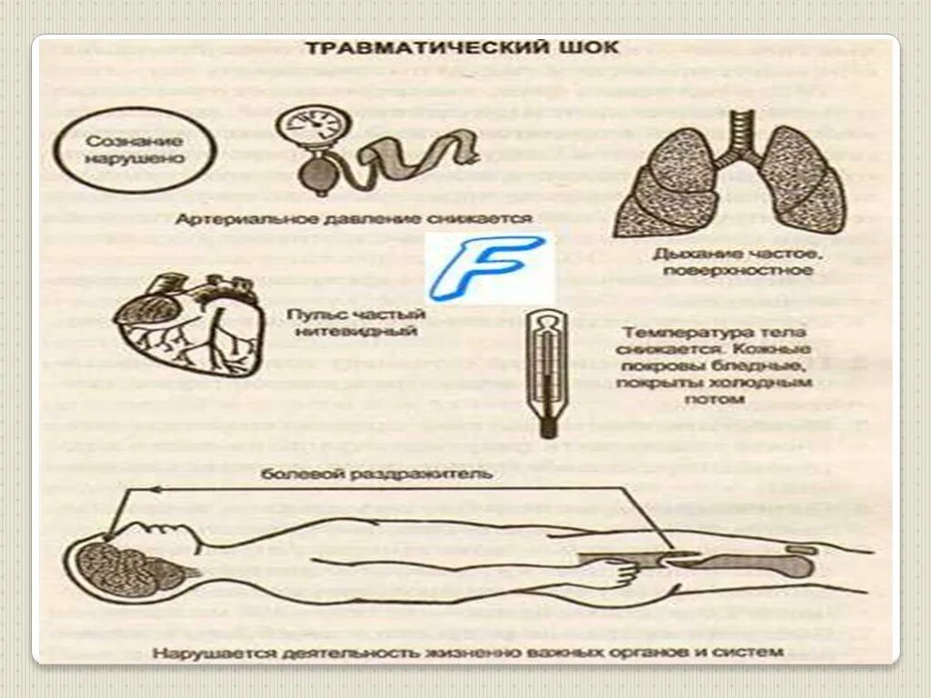 Кома от стресса. Общая реакция организма на повреждения стресс ШОК коллапс. Общие реакции организма на повреждение. Общие реакции организма ШОК стресс кома. Травматический ШОК.