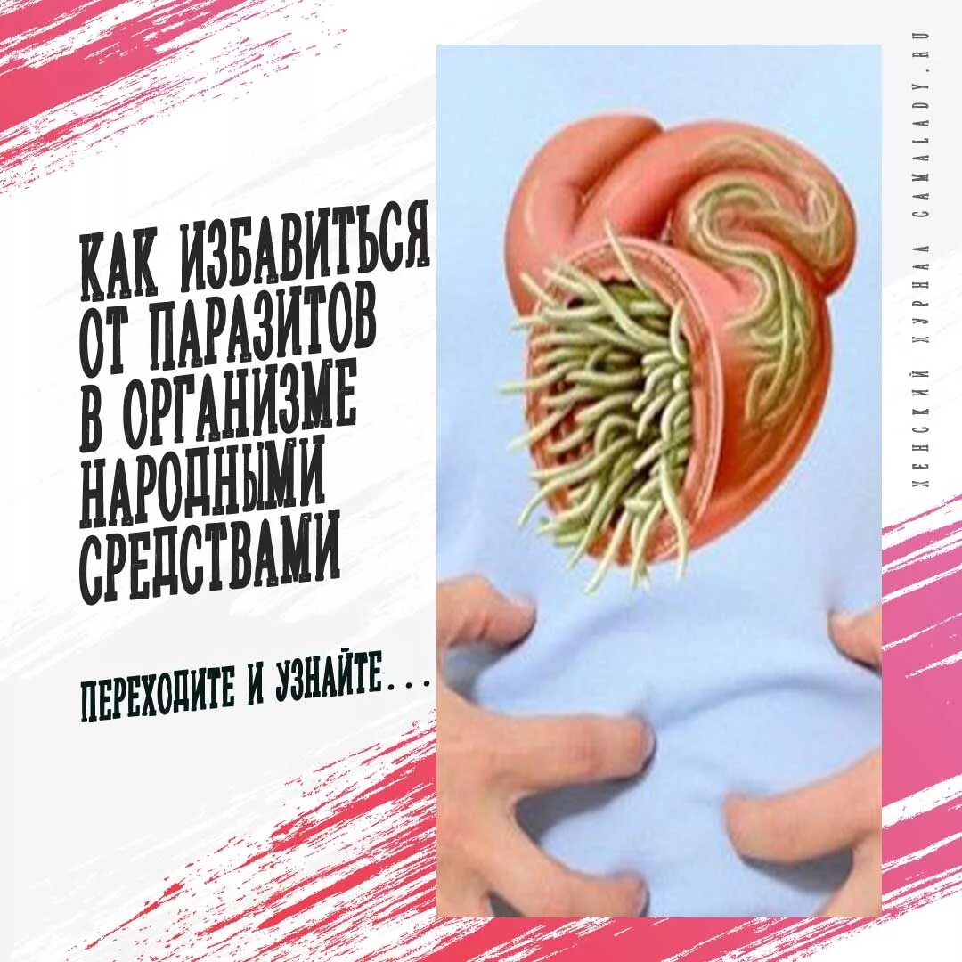 Как выводят глистов из организма. Избавление от червей в организме. как избавиться от глистов. избавление от паразитов.