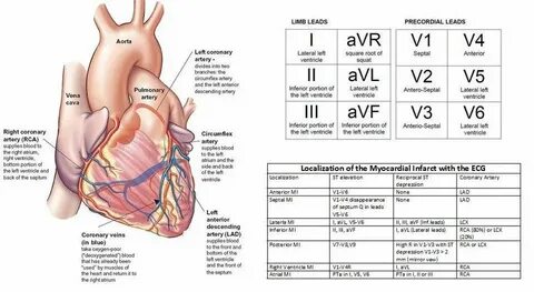 Map of the heart