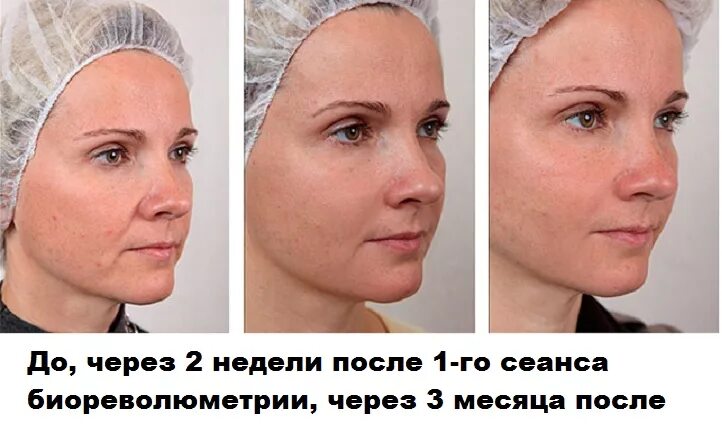 Через 3 дня после