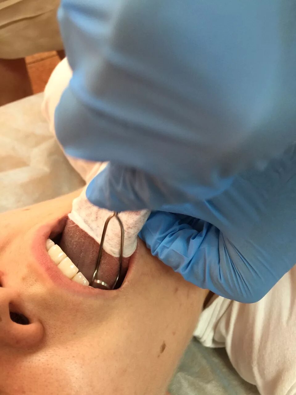 Логомассаж новиковой. Логопедический массаж для детей. Зондовый логопедический массаж при дизартрии. Зондовый логопедический массаж. Логопедический массаж по новиковой.