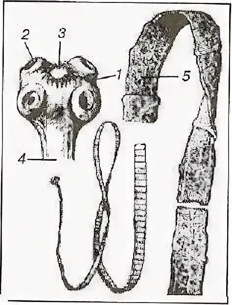 Какая стадия свиного цепня разовьется. Ленточные черви свиной цепень. Ленточный цепень строение. Бычий цепень рисунок цикл. Строение ленточной стадии свиной цепень.
