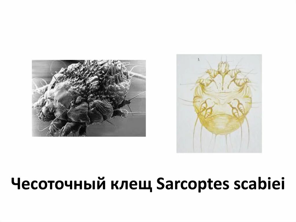 Почему чесоточного клеща называют зуднем обоснуйте
