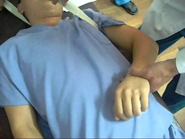 Операция вывих. Вправить вывих плечевого сустава. вывих руки в плечевом суставе. вывих плечевой кости вправление.