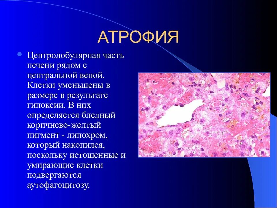 Регенерация гипертрофия атрофия. Атрофия патологическая анатомия. Атрофия латынь