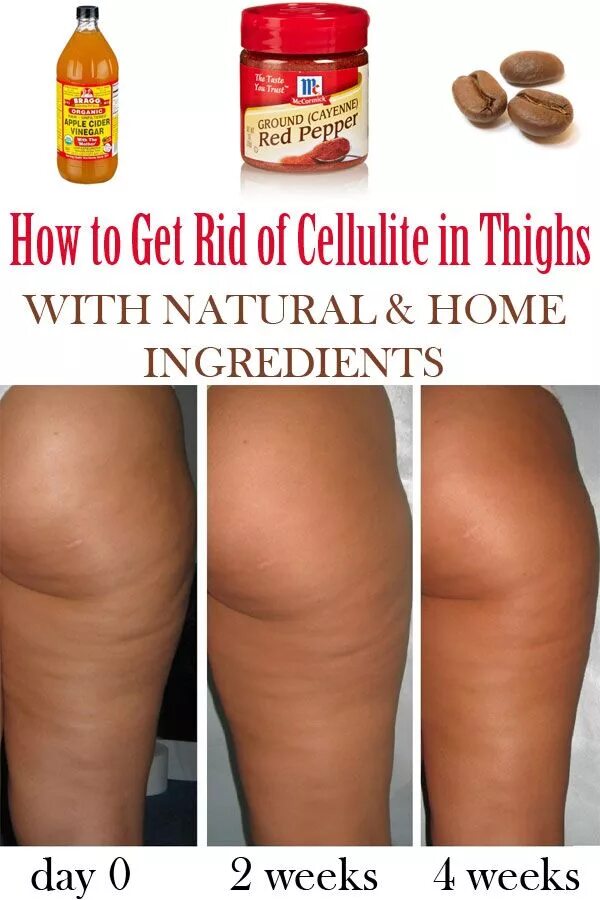 Тренировки от целлюлита. Занятия против целлюлита. Упражнения для целлюлита. Упражнения против целлюлита. Тренировка от целлюлита.