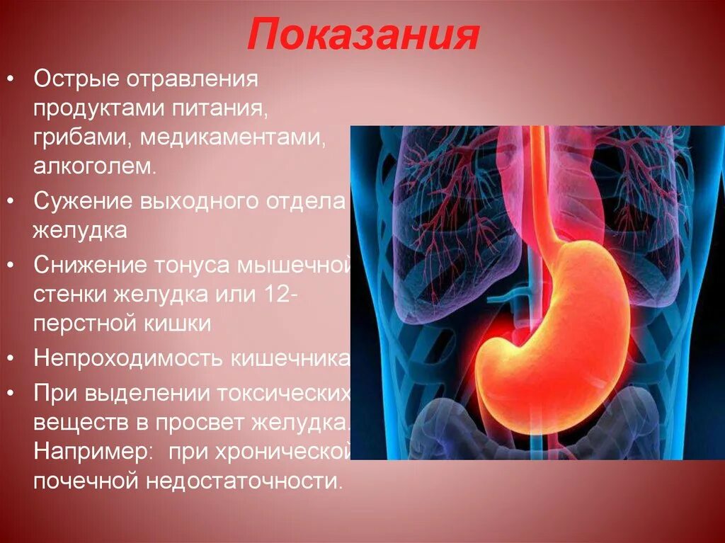 Желудочное отравление. Желудок при отравлении. Желудок после отравления. Что делать если остановился желудок