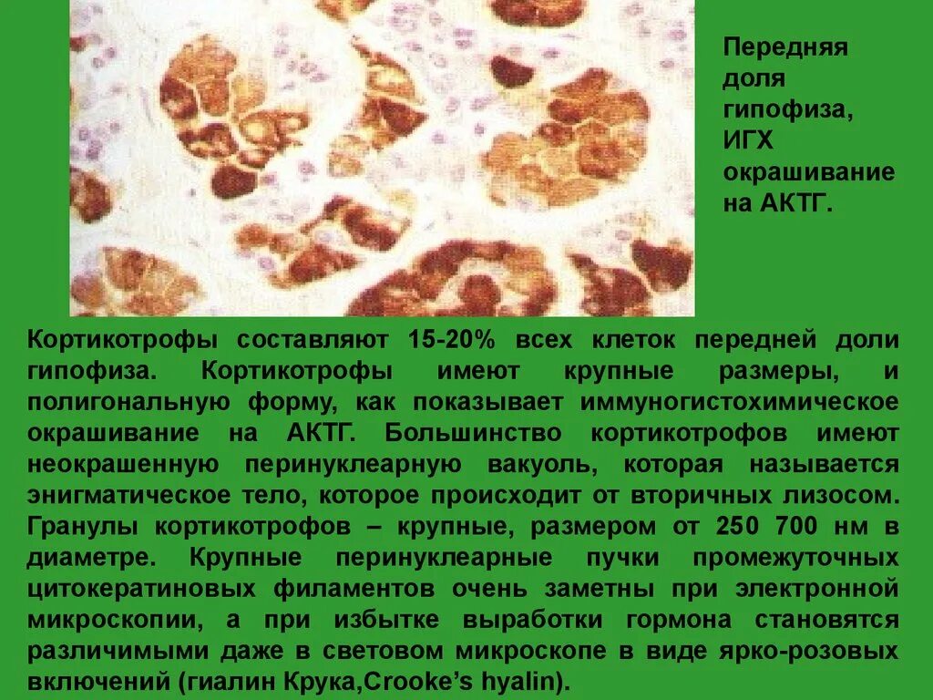 Базофильные клетки передней доли гипофиза вырабатывают. Ацидофилы. Хромофобные аденоциты гипофиза гистология. Хромофобные эндокриноциты гипофиза. Окраска толуидиновым синим.