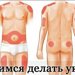 Постановка инъекций в бедро